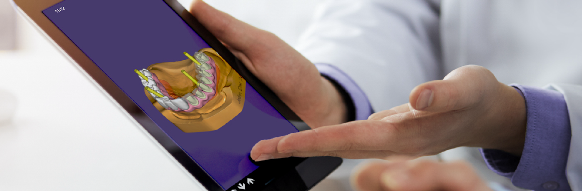 exocad webview - STL 3D Viewer